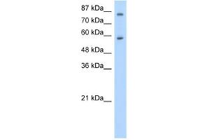 WB Suggested Anti-ZNF777 Antibody Titration:  0. (ZNF777 抗体  (C-Term))
