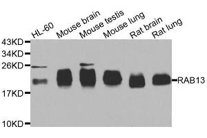 Western blot analysis of extracts of various cell lines, using RAB31 antibody. (RAB31 抗体  (AA 1-195))