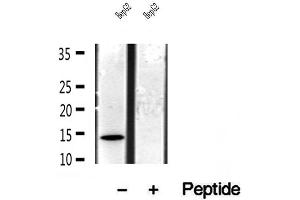 Western blot analysis of extracts of HepG2 cells, using CISD1 antibody. (CISD1 抗体  (Internal Region))