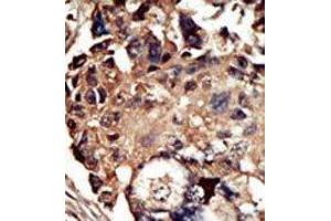 Image no. 2 for anti-Protein Kinase C and Casein Kinase Substrate in Neurons 1 (PACSIN1) (N-Term) antibody (ABIN360553)