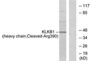 Western blot analysis of extracts from HeLa cells, using KLKB1 (heavy chain,Cleaved-Arg390) Antibody. (KLKB1 抗体  (Cleaved-Arg390))