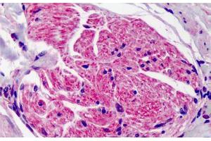 Anti-SUMO2/SUMO3 antibody IHC of human adrenal. (SUMO2 抗体  (AA 49-81))
