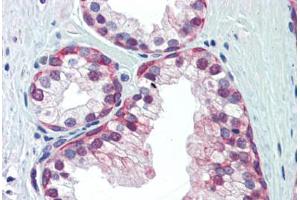 Human Prostate (formalin-fixed, paraffin-embedded) stained with NRF1 antibody ABIN462197 followed by biotinylated goat anti-rabbit IgG secondary antibody ABIN481713, alkaline phosphatase-streptavidin and chromogen. (NRF1 抗体  (AA 360-409))