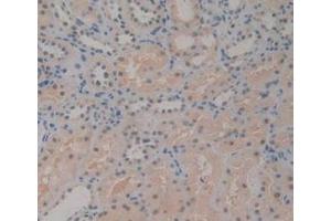 Immunohistochemistry (IHC) image for anti-Killer Cell Lectin-Like Receptor Subfamily B, Member 1 (KLRB1) (AA 73-188) antibody (ABIN7439978)