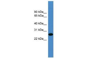 WB Suggested Anti-TIMP2 Antibody Titration: 0. (TIMP2 抗体  (N-Term))