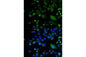 Immunofluorescence analysis of A549 cell using BCL10 antibody. (BCL10 抗体  (AA 1-233))