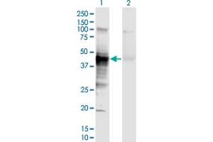 Western Blot analysis of HLA-A expression in transfected 293T cell line by HLA-A monoclonal antibody (M01), clone 2D6. (HLA-A 抗体  (AA 24-365))