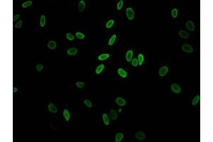 Immunofluorescent analysis of Hela cells (sodium butyrate, 30 mM, 4h) using ABIN7139148 at dilution of 1:100 and Alexa Fluor 488-congugated AffiniPure Goat Anti-Rabbit IgG(H+L) (H2AFZ 抗体  (acLys11))
