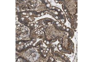 Immunohistochemical staining of human colon with ZDHHC5 polyclonal antibody  shows strong membranous positivity in glandular cells.