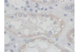 Detection of SGSH in Human Kidney Tissue using Polyclonal Antibody to N-Sulfoglucosamine Sulfohydrolase (SGSH) (SGSH 抗体  (AA 21-389))