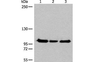 Western blot analysis of Hela K562 and HEPG2 cell lysates using XPO1 Polyclonal Antibody at dilution of 1:200 (XPO1 抗体)