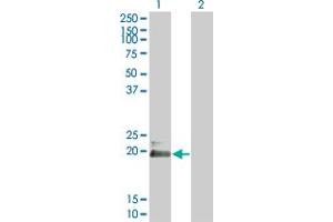Western Blot analysis of HAND2 expression in transfected 293T cell line by HAND2 monoclonal antibody (M03), clone 3E3. (HAND2 抗体  (AA 135-216))