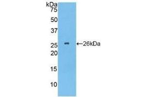 Detection of Recombinant TPPP, Human using Polyclonal Antibody to Tubulin Polymerization Promoting Protein (TPPP) (Tppp 抗体  (AA 8-210))