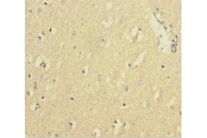 Immunohistochemistry of paraffin-embedded human brain tissue using ABIN7152719 at dilution of 1:100 (FTL 抗体  (AA 2-175))