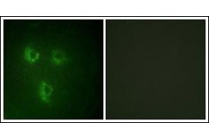 Immunofluorescence analysis of HuvEc cells, using TMEPA Antibody. (PMEPA1 抗体)