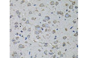 Immunohistochemistry of paraffin-embedded Mouse brain using IL1A Polyclonal Antibody at dilution of 1:100 (40x lens). (IL1A 抗体)