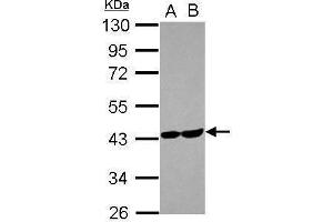 WB Image Sample (30 ug of whole cell lysate) A: U87-MG B: MCF-7 10% SDS PAGE antibody diluted at 1:1000 (ALDOC 抗体)