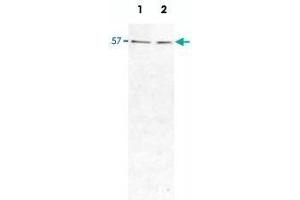 Western Blot analysis of HIP1R protein in HeLa cell (Lane 1) and rat brain (Lane 2) lysates, using HIP1R monoclonal antibody, clone 1E5  at 1 : 1000 dilution. (HIP1R 抗体)