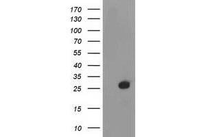 Western Blotting (WB) image for anti-Deoxythymidylate Kinase (Thymidylate Kinase) (DTYMK) antibody (ABIN1497922) (DTYMK 抗体)