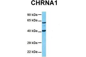 Host:  Rabbit  Target Name:  CHRNA1  Sample Tissue:  Human Fetal Lung  Antibody Dilution:  1. (CHRNA1 抗体  (C-Term))
