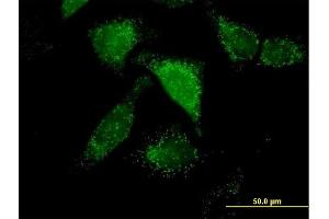 Immunofluorescence of purified MaxPab antibody to ACOX1 on HeLa cell. (ACOX1 抗体  (AA 1-660))