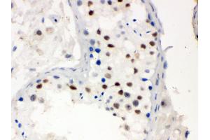 Immunohistochemistry (IHC) image for anti-Menage A Trois Homolog 1, Cyclin H Assembly Factor (Xenopus Laevis) (MNAT1) (AA 92-278) antibody (ABIN3043583)