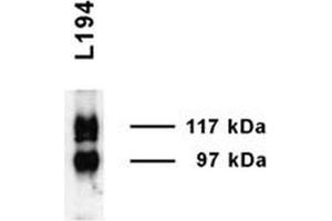 Western blot analysis of Rat Inner medulla showing detection of UT-A1 protein using Rabbit Anti-UT-A1 Polyclonal Antibody . (Solute Carrier Family 14 (Urea Transporter, Kidney) Member 2 (SLC14A2) (AA 911-929) 抗体 (PE))