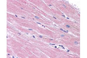 Immunohistochemistry (IHC) image for anti-Phosphatidic Acid Phosphatase Type 2 Domain Containing 3 (PPAPDC3) (N-Term) antibody (ABIN605141)