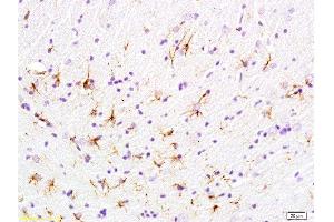 Formalin-fixed and paraffin embedded rat brain labeled with Anti-phospho-GFAP Polyclonal Antibody, Unconjugated  at 1:200 followed by conjugation to the secondary antibody and DAB staining (GFAP 抗体  (pSer8))