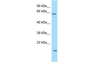 WB Suggested Anti-SOWAHC Antibody Titration: 1. (ANKRD57 抗体  (C-Term))