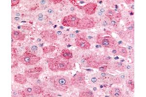 Anti-MINK1 / MINK antibody IHC of human liver. (MAP4K6 抗体  (Internal Region))