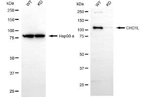 anti-Chromodomain Helicase DNA Binding Protein 1-Like (CHD1L) antibody