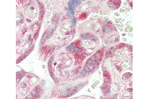 Formalin-fixed and paraffin-embedded H.