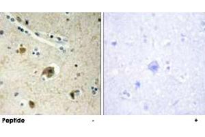 Immunohistochemistry analysis of paraffin-embedded human brain tissue using COL4A4 polyclonal antibody . (Col4a4 抗体)