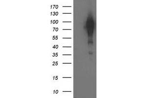 HEK293T cells were transfected with the pCMV6-ENTRY control (Left lane) or pCMV6-ENTRY BCAR1 (Right lane) cDNA for 48 hrs and lysed. (BCAR1 抗体)