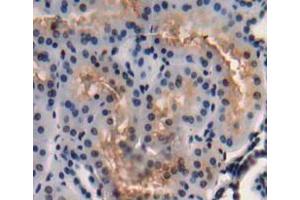 Used in DAB staining on fromalin fixed paraffin- embedded Kidney tissue (C3orf15 抗体  (AA 29-181))