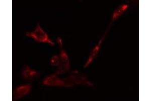 ABIN6275123 staining Hela cells by IF/ICC. (EIF5B 抗体  (C-Term))