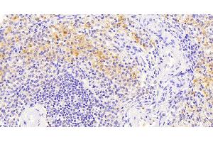 Immunohistochemistry (IHC) image for anti-Vav 3 Oncogene (VAV3) (Internal Region) antibody (ABIN185278)
