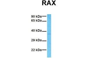 Host:  Rabbit  Target Name:  RAX  Sample Tissue:  Human Fetal Lung  Antibody Dilution:  1.