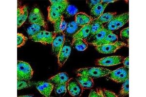 Immunofluorescence (IF) image for anti-Tumor Protein P53 (TP53) (AA 33-62) antibody (ABIN3029394)