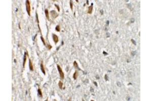 Immunohistochemistry of TSHZ3 in mouse brain tissue with TSHZ3 / ZNF537 Antibody at 2. (TSHZ3 抗体  (N-Term))