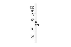 CTGF Antibody (Center) (ABIN392205 and ABIN2841905) western blot analysis in mouse bladder tissue lysates (35 μg/lane). (CTGF 抗体  (AA 134-159))