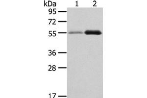 Western Blot analysis of Human normal stomach and thyroid cancer tissue using XKR3 Polyclonal Antibody at dilution of 1/330 (XKR3 抗体)