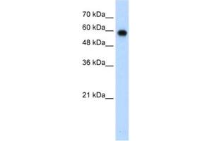 Western Blotting (WB) image for anti-SWI/SNF Related, Matrix Associated, Actin Dependent Regulator of Chromatin, Subfamily D, Member 2 (SMARCD2) antibody (ABIN2461675) (SMARCD2 抗体)