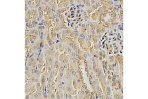 Immunohistochemistry of paraffin-embedded mouse kidney using HDAC6 antibody (ABIN5997884) at dilution of 1/100 (40x lens). (HDAC6 抗体)