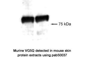 Image no. 1 for anti-Angiogenic Factor with G Patch and FHA Domains 1 (AGGF1) (AA 300-400) antibody (ABIN363346) (AGGF1 抗体  (AA 300-400))