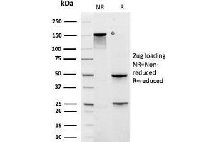 SDS-PAGE Analysis Purified KRT6A Recombinant Mouse Monoclonal Antibody (rKRT6A/2100). (Recombinant KRT6A 抗体)