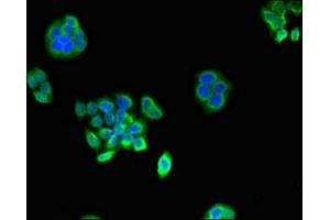 Immunofluorescent analysis of PC-3 cells using ABIN7164944 at dilution of 1:100 and Alexa Fluor 488-congugated AffiniPure Goat Anti-Rabbit IgG(H+L) (PSMA1 抗体  (AA 163-263))