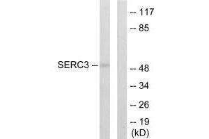 Western blot analysis of extracts from 293 cells, using SERC3 antibody. (SERINC3 抗体  (C-Term))