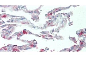 Immunohistochemistry of paraffin-embedded Human Lung tissue using SLC34A2 Polyclonal Antibody at dilution of 1:60. (SLC34A2 抗体)